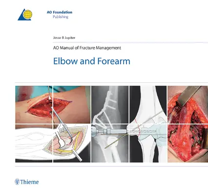 Manuel Ao de gestion des fractures - coude et avant-bras - Ao Manual of Fracture Management - Elbow & Forearm