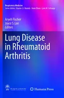 Les maladies pulmonaires dans la polyarthrite rhumatoïde - Lung Disease in Rheumatoid Arthritis