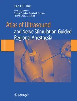 Atlas de l'anesthésie régionale guidée par ultrasons et stimulation nerveuse - Atlas of Ultrasound and Nerve Stimulation-Guided Regional Anesthesia