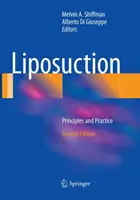 Liposuccion : Principes et pratique - Liposuction: Principles and Practice