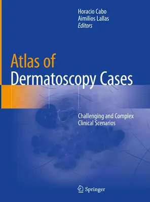 Atlas des cas de dermatoscopie : Scénarios cliniques difficiles et complexes - Atlas of Dermatoscopy Cases: Challenging and Complex Clinical Scenarios