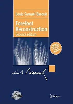 Reconstruction de l'avant-pied - Forefoot Reconstruction