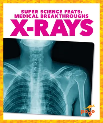 Rayons X - X-Rays