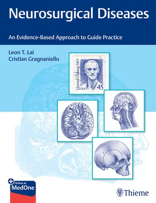 Maladies neurochirurgicales : Une approche fondée sur des données probantes pour guider la pratique - Neurosurgical Diseases: An Evidence-Based Approach to Guide Practice