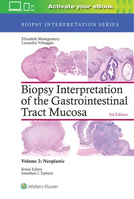 Interprétation des biopsies de la muqueuse du tractus gastro-intestinal : Volume 2 : Néoplasique - Biopsy Interpretation of the Gastrointestinal Tract Mucosa: Volume 2: Neoplastic