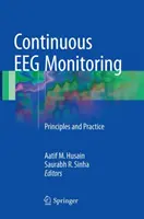 Surveillance continue de l'EEG : Principes et pratique - Continuous Eeg Monitoring: Principles and Practice