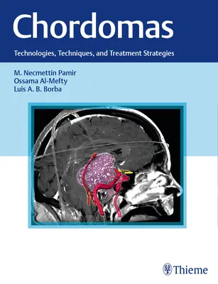Chordomes : Technologies, techniques et stratégies de traitement - Chordomas: Technologies, Techniques, and Treatment Strategies