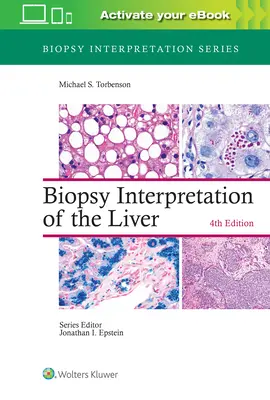 Interprétation des biopsies du foie - Biopsy Interpretation of the Liver