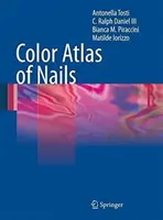 Atlas en couleur des ongles - Color Atlas of Nails