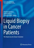 Biopsie liquide chez les patients atteints de cancer : La lentille de la main pour l'évolution des tumeurs - Liquid Biopsy in Cancer Patients: The Hand Lens for Tumor Evolution
