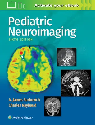 Neuroimagerie pédiatrique - Pediatric Neuroimaging