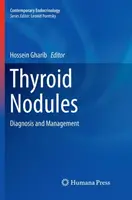 Nodules thyroïdiens : Diagnostic et prise en charge - Thyroid Nodules: Diagnosis and Management