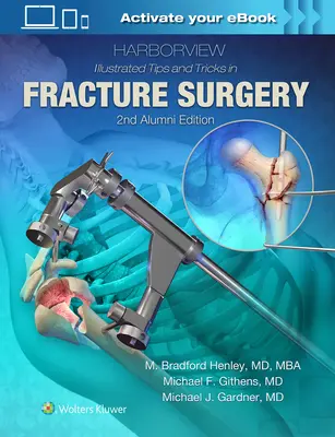 Harborview Illustrated Tips and Tricks in Fracture Surgery (en anglais) - Harborview Illustrated Tips and Tricks in Fracture Surgery