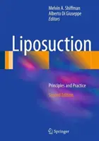 Liposuccion : Principes et pratique - Liposuction: Principles and Practice