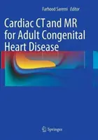 TDM et RM cardiaques pour les cardiopathies congénitales de l'adulte - Cardiac CT and MR for Adult Congenital Heart Disease