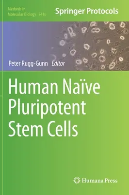 Cellules souches pluripotentes de la nef humaine - Human Nave Pluripotent Stem Cells
