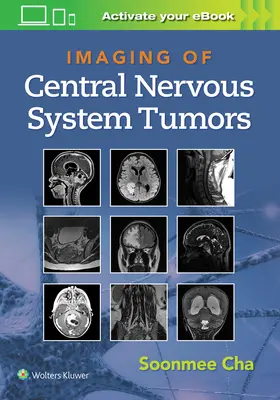 Imagerie des tumeurs du système nerveux central - Imaging of Central Nervous System Tumors