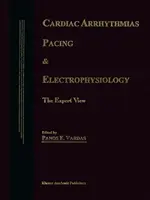 Arythmies cardiaques, stimulation et électrophysiologie : Le point de vue des experts - Cardiac Arrhythmias, Pacing & Electrophysiology: The Expert View