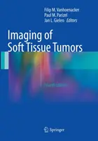 Imagerie des tumeurs des tissus mous - Imaging of Soft Tissue Tumors