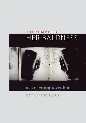 L'été de sa calvitie : Une improvisation sur le cancer - The Summer of Her Baldness: A Cancer Improvisation