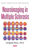 La neuro-imagerie dans la sclérose en plaques - Neuroimaging in Multiple Sclerosis