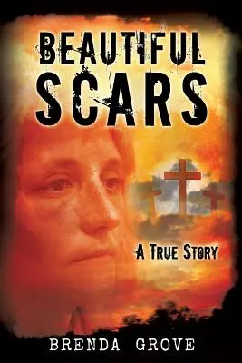 De belles cicatrices - Beautiful Scars