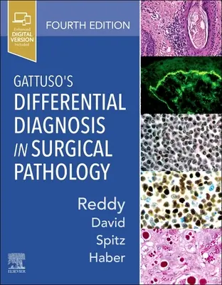 Le diagnostic différentiel de Gattuso en pathologie chirurgicale - Gattuso's Differential Diagnosis in Surgical Pathology