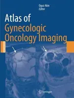 Atlas de l'imagerie en oncologie gynécologique - Atlas of Gynecologic Oncology Imaging