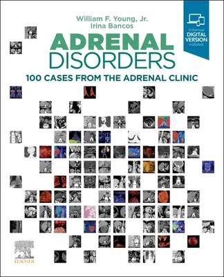 Troubles surrénaliens : 100 cas de la clinique de la surrénale - Adrenal Disorders: 100 Cases from the Adrenal Clinic