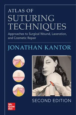 Atlas des techniques de suture : Approches de la réparation chirurgicale des plaies, des lacérations et de l'esthétique, deuxième édition - Atlas of Suturing Techniques: Approaches to Surgical Wound, Laceration, and Cosmetic Repair, Second Edition
