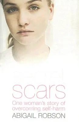 Secret Scars : L'histoire d'une femme qui a surmonté l'automutilation - Secret Scars: One Woman's Story of Overcoming Self-Harm