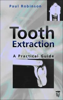 Extraction dentaire : Guide pratique - Tooth Extraction: A Practical Guide