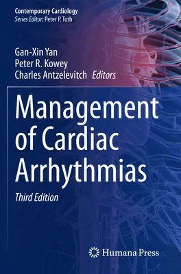 Gestion des arythmies cardiaques - Management of Cardiac Arrhythmias