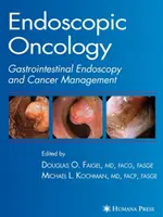 Oncologie endoscopique - Endoscopic Oncology