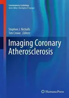 Imagerie de l'athérosclérose coronarienne - Imaging Coronary Atherosclerosis