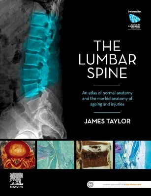 La colonne lombaire : Atlas de l'anatomie normale et de l'anatomie morbide du vieillissement et des blessures - The Lumbar Spine: An Atlas of Normal Anatomy and the Morbid Anatomy of Ageing and Injury