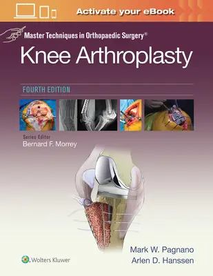 Techniques maîtresses en chirurgie orthopédique : Arthroplastie du genou - Master Techniques in Orthopedic Surgery: Knee Arthroplasty