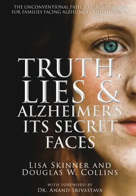 Vérité, mensonges et Alzheimer : Ses visages secrets - Truth, Lies & Alzheimer's: Its Secret Faces