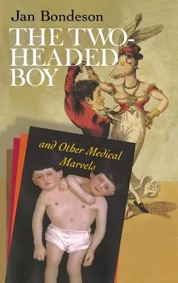 Le garçon à deux têtes et autres merveilles médicales - Two-Headed Boy, and Other Medical Marvels