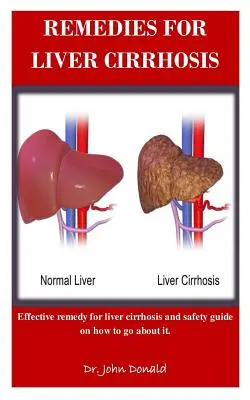 Remèdes pour la cirrhose du foie : Remèdes efficaces contre la cirrhose du foie et guide de sécurité sur la façon de procéder - Remedies For Liver Cirrhosis: Effective remedies for liver cirrhosis and safety guide on how to go about it