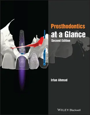 La prosthodontie en un coup d'œil - Prosthodontics at a Glance