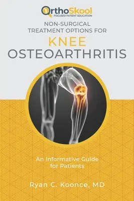 Options de traitement non chirurgical de l'arthrose du genou : Un guide d'information pour les patients - Non-Surgical Treatment Options for Knee Osteoarthritis: An Informative Guide for Patients