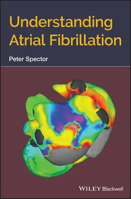 Comprendre la fibrillation auriculaire - Understanding Atrial Fibrillation