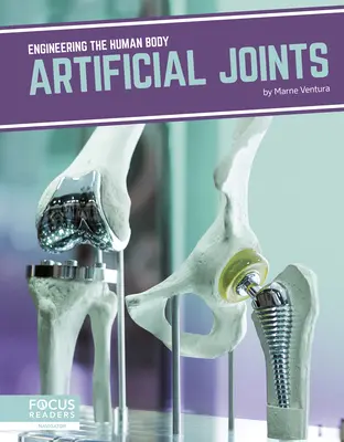 Articulations artificielles - Artificial Joints