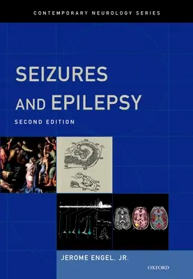 Les crises et l'épilepsie - Seizures and Epilepsy