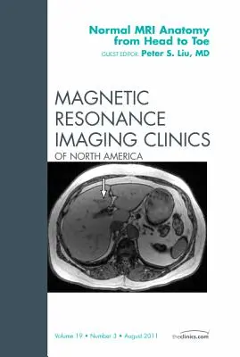 Normal MR Anatomy from Head to Toe, un numéro de Magnetic Resonance Imaging Clinics : Volume 19-3 - Normal MR Anatomy from Head to Toe, an Issue of Magnetic Resonance Imaging Clinics: Volume 19-3