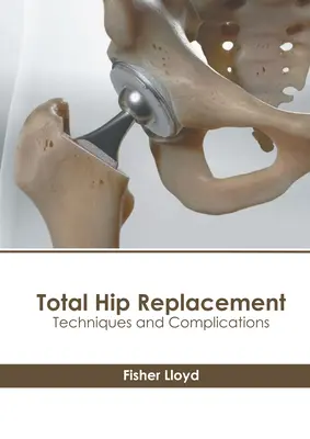 L'arthroplastie totale de la hanche : Techniques et complications - Total Hip Replacement: Techniques and Complications