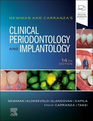 Parodontologie clinique et implantologie de Newman et Carranza - Newman and Carranza's Clinical Periodontology and Implantology