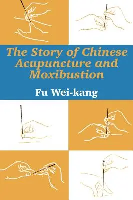 L'histoire de l'acupuncture et de la moxibustion chinoises - The Story of Chinese Acupuncture and Moxibustion