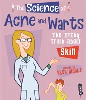 Science de l'acné et des verrues - La vérité sur la peau qui démange - Science of Acne & Warts - The Itchy Truth About Skin